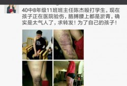 最新爆料老师打学生,最新爆料揭露老师对学生施暴事件